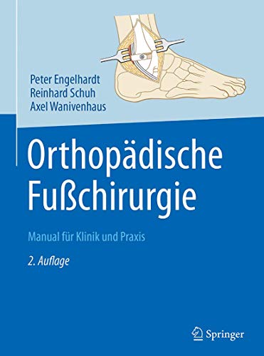 Orthopädische Fußchirurgie: Manual für Klinik und Praxis von Springer